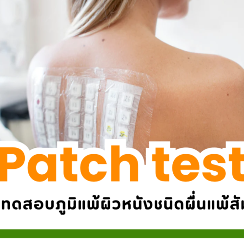 หมดปัญหาผื่นแพ้แบบไร้สาเหตุ เริ่มต้นด้วย “Patch Test”