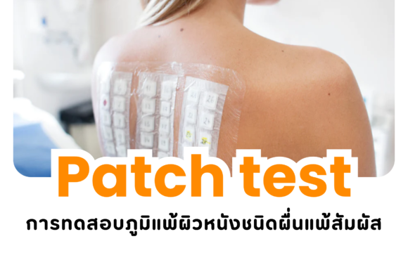 หมดปัญหาผื่นแพ้แบบไร้สาเหตุ เริ่มต้นด้วย “Patch Test”