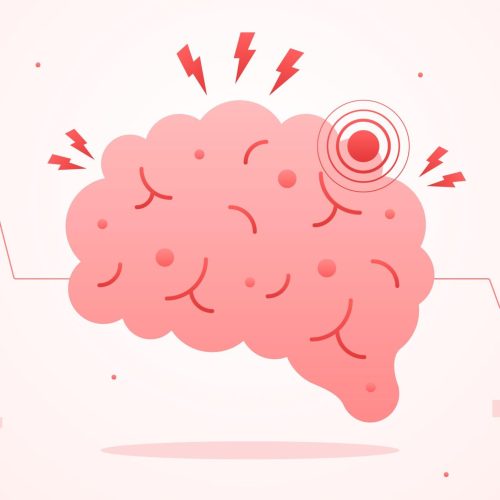 5809903 Stroke โรคหลอดเลือดสมอง รู้ทัน ป้องกันได้🩺🧠