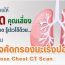 โปรแกรมตรวจคัดกรองมะเร็งปอด ( Low-dose Chest CT Scan) เทคโนโลยีที่แม่นยำ ปลอดภัยมากขึ้น