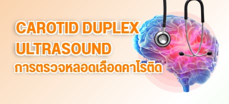 การตรวจคัดกรองความเสี่ยงด้วยโปรแกรม การตรวจหลอดเลือดคาโรติด